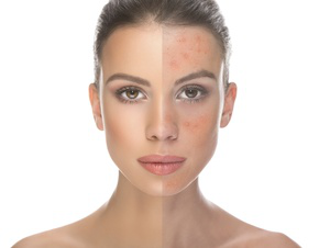 cosmetic dermatologist dallas