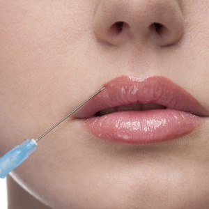 Injectable Dermal Fillers dallas