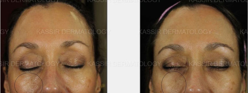 Skin Rejuvenation dallas image