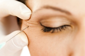 Botox Injections dallas