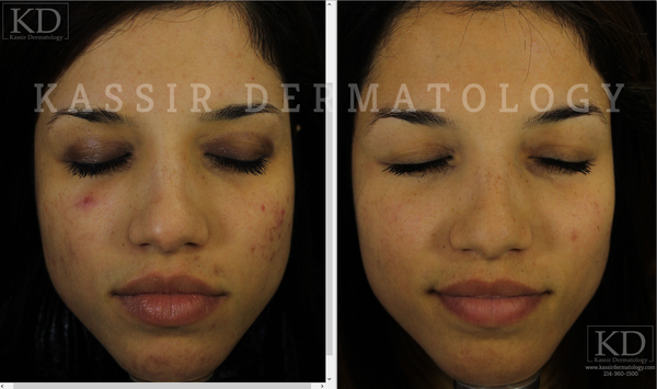 cosmetic dermatologist dallas