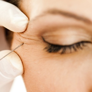 Botox Injections dallas