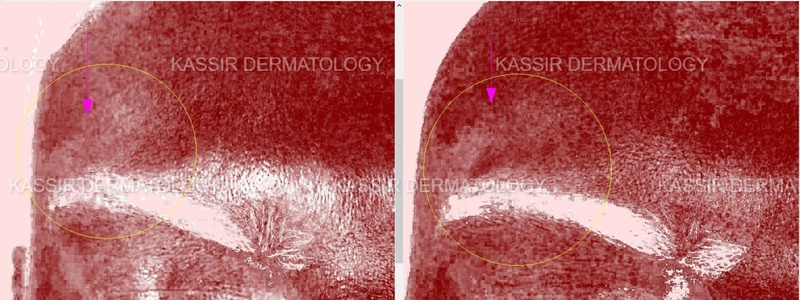 Skin Rejuvenation dallas image